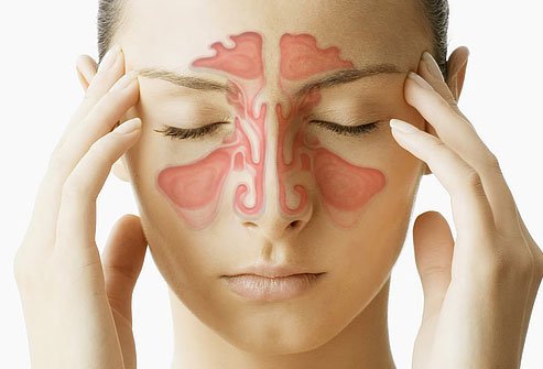 O Que É Sinusite – Causas, Sintomas e Tratamento