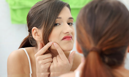 Acne Cística – O Que É, Tratamentos e Maquiagem Para Esconder
