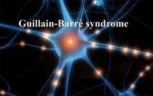 Guillain-Barré Síndrome – O que é, Causas, Sintomas e Tratamento