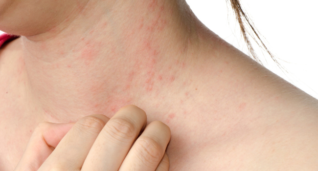 Alergia Cosméticos em Tempo Seco – Como Evitar