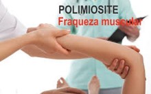 Polimiosite – O Que É, Sintomas e Tratamento