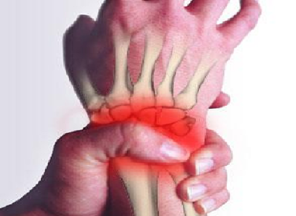 Tendinite Nas Mãos – Sintomas e Exercícios Preventivos