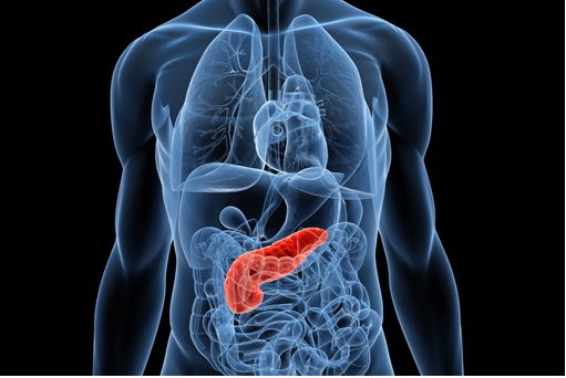 Pancreatite - O Que É, Causas e Como Tratar
