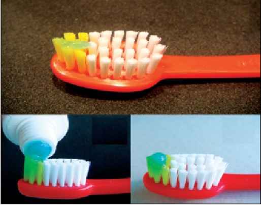 fluorose-dentaria-manchas-nos-dentes-evitar