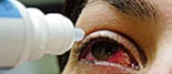 Síndrome do Olho Seco – Causas e Sintomas