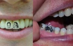 Tatuagem Nos Dentes – Como Funciona e Desenhos