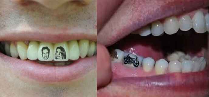 Tatuagem Nos Dentes – Como Funciona e Desenhos