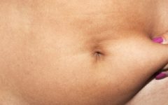 Diástase Abdominal – Como Tratar