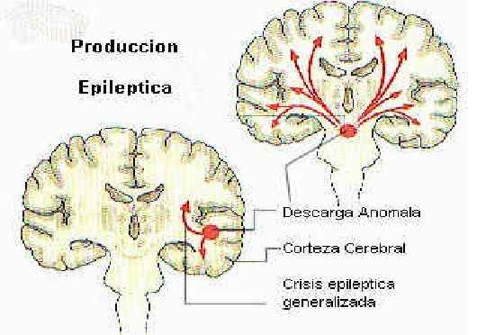 Epilepsia Em Cães - Sintomas