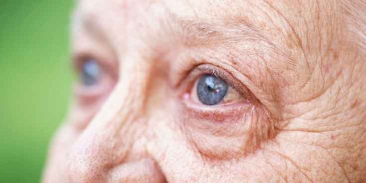 Degeneração Macular Relacionada à Idade – Sintomas e Tratamento