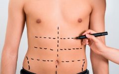 Abdominoplastia Masculina – Como Funciona e Indicações