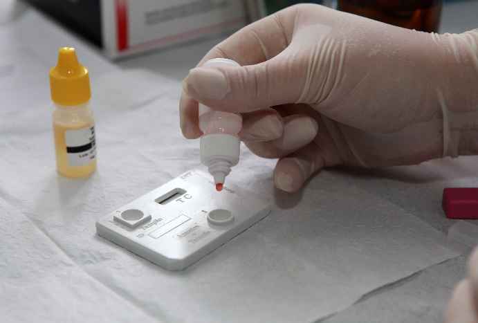 Sífilis a Hepatites e HIV – Onde Fazer Testes Rápidos