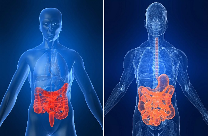 Doença de Crohn – Sintomas e Causas