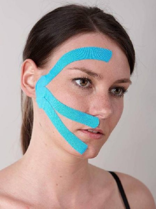 Taping Facial – Benefícios